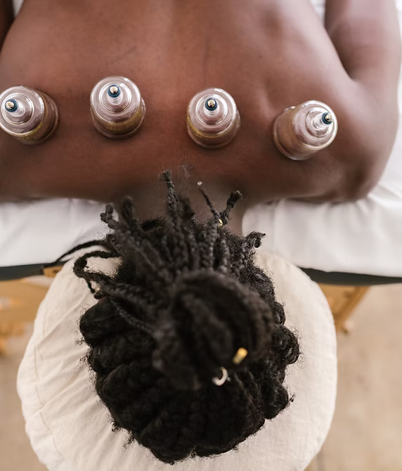 Cupping Therapy